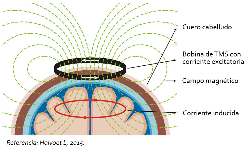 neuromodulacion, estimulacionn, magnetica, transcraneal